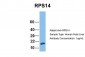 RPS14 antibody - middle region
